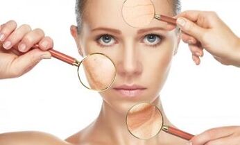 what skin problems does laser fractional rejuvenation solve